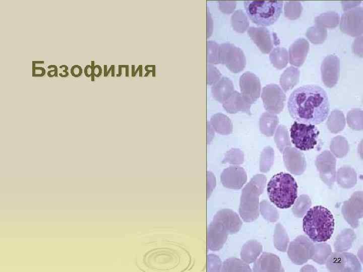 Базофилия 22 