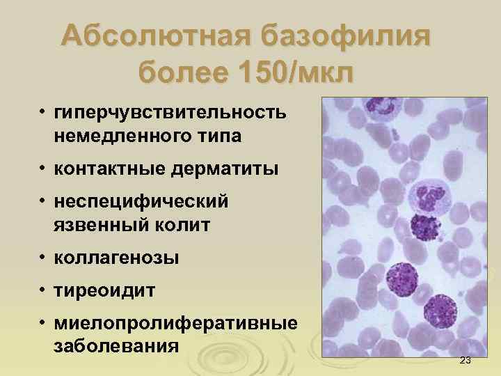 Абсолютная базофилия более 150/мкл • гиперчувствительность немедленного типа • контактные дерматиты • неспецифический язвенный