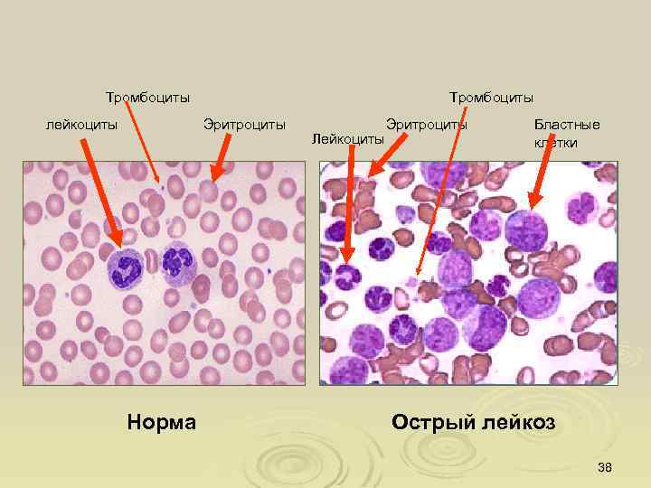 Эритроциты лейкоциты тромбоциты рисунок