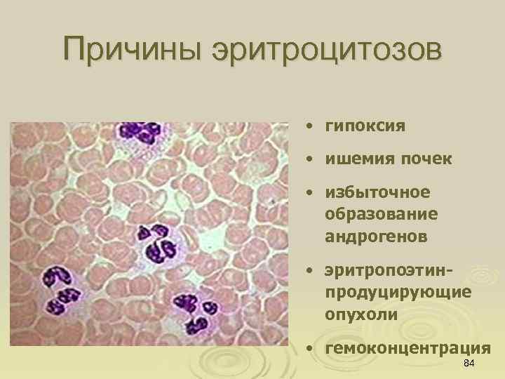 Причины эритроцитозов • гипоксия • ишемия почек • избыточное образование андрогенов • эритропоэтинпродуцирующие опухоли