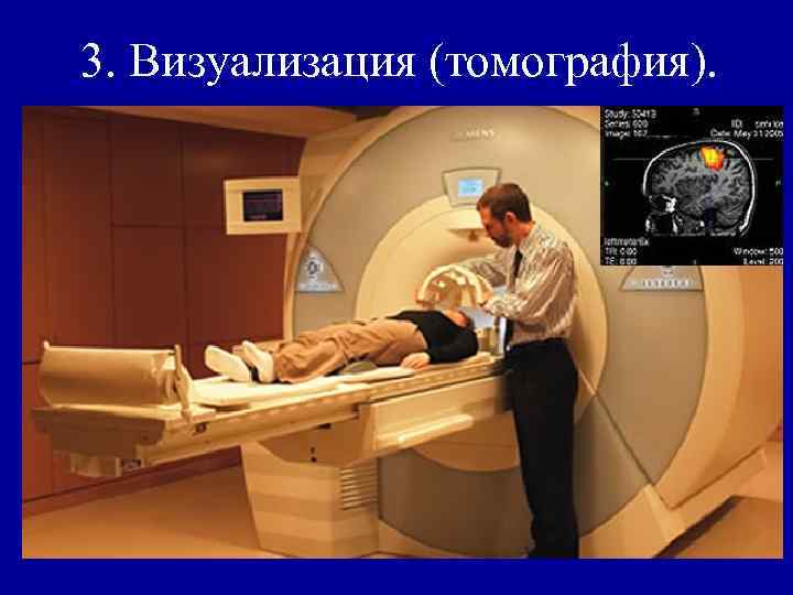 3. Визуализация (томография). 
