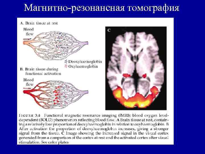 Магнитно-резонансная томография 