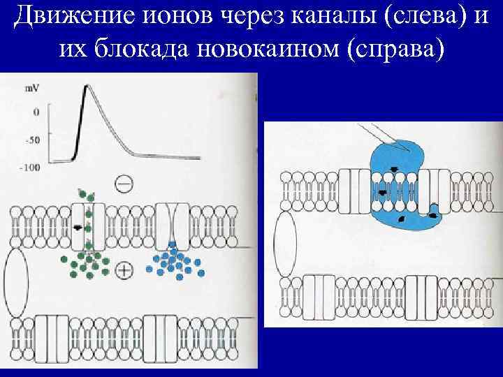 Движение ионов через каналы (слева) и их блокада новокаином (справа) 