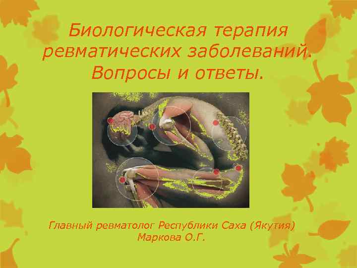 Биологическая терапия ревматических заболеваний. Вопросы и ответы. Главный ревматолог Республики Саха (Якутия) Маркова О.