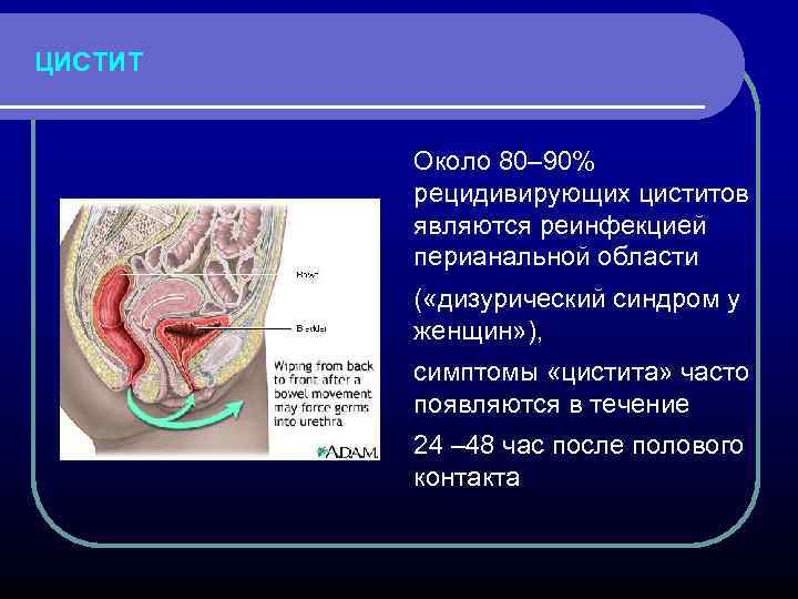 ЦИСТИТ Около 80– 90% рецидивирующих циститов являются реинфекцией перианальной области ( «дизурический синдром у