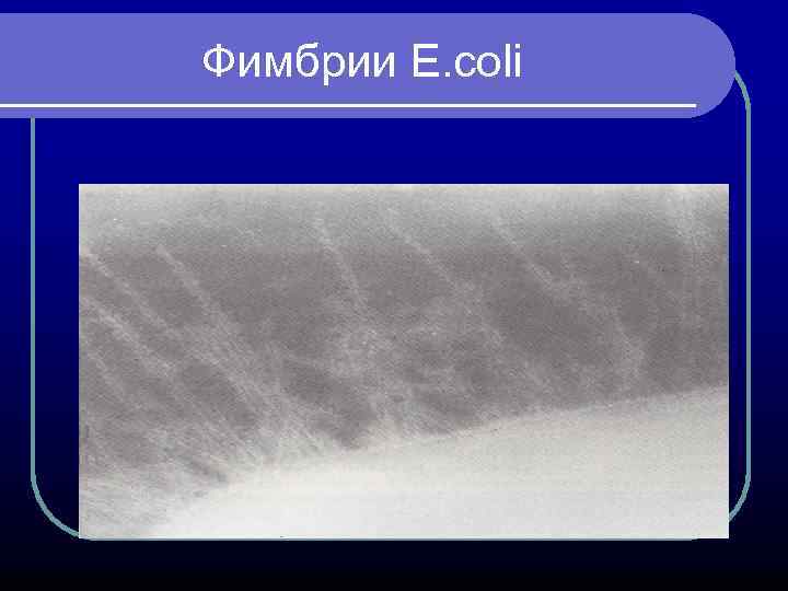 Фимбрии E. coli 