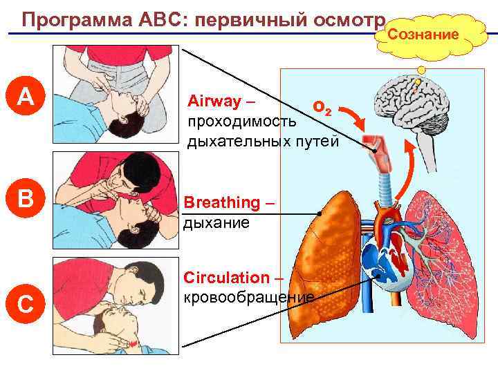 Программа АВС: первичный осмотр A В С Airway – О 2 проходимость дыхательных путей