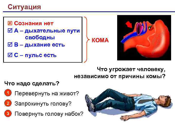 Ситуация Сознания нет А – дыхательные пути свободны В – дыхание есть КОМА С