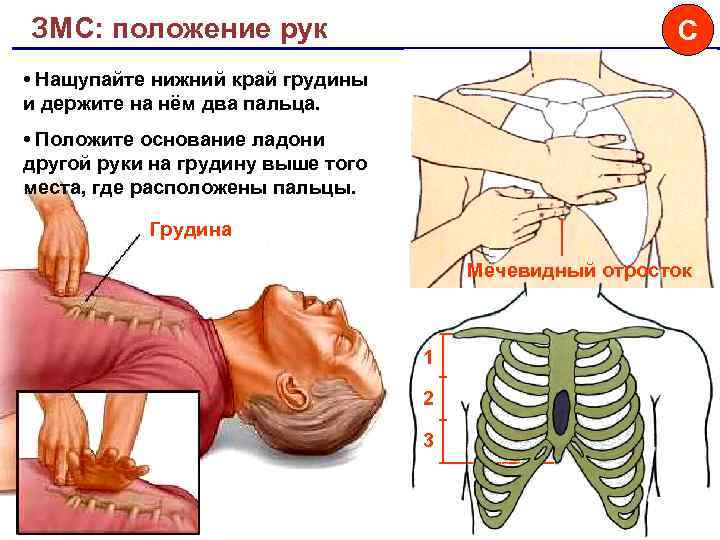 ЗМС: положение рук C • Нащупайте нижний край грудины и держите на нём два