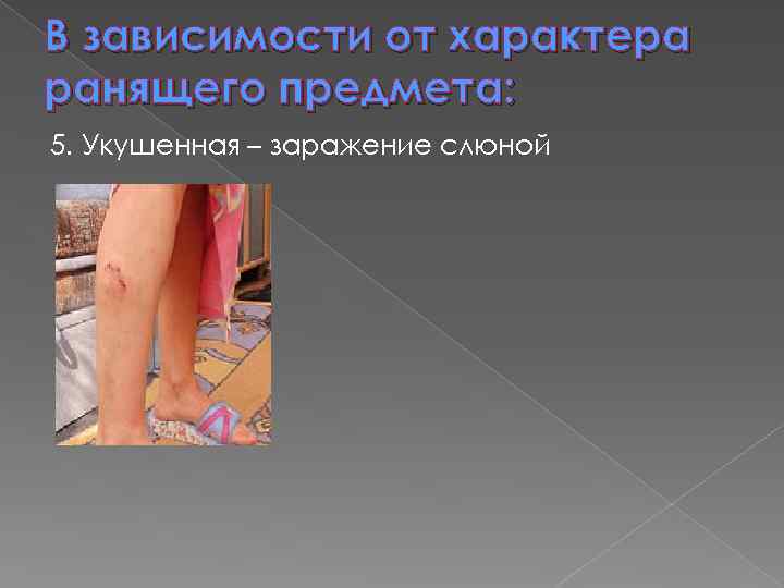 В зависимости от характера ранящего предмета: 5. Укушенная – заражение слюной 