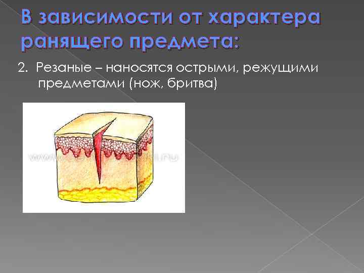 В зависимости от характера ранящего предмета: 2. Резаные – наносятся острыми, режущими предметами (нож,