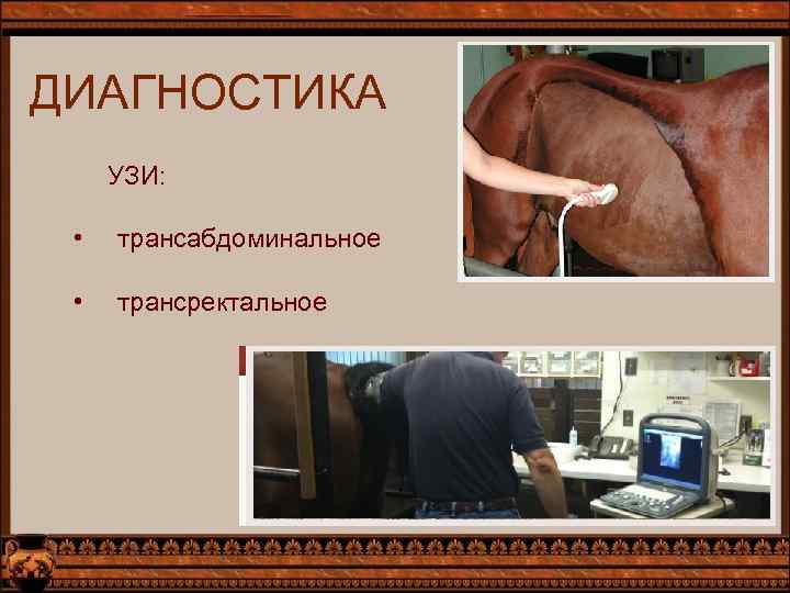 ДИАГНОСТИКА УЗИ: • трансабдоминальное • трансректальное 