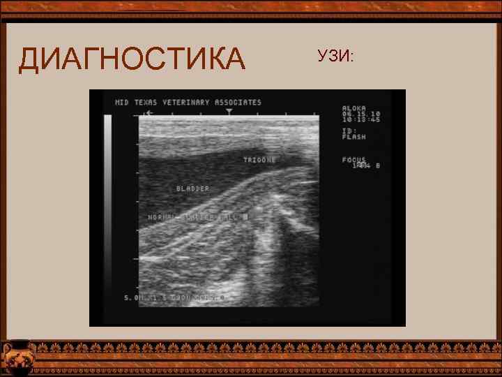 ДИАГНОСТИКА УЗИ: 
