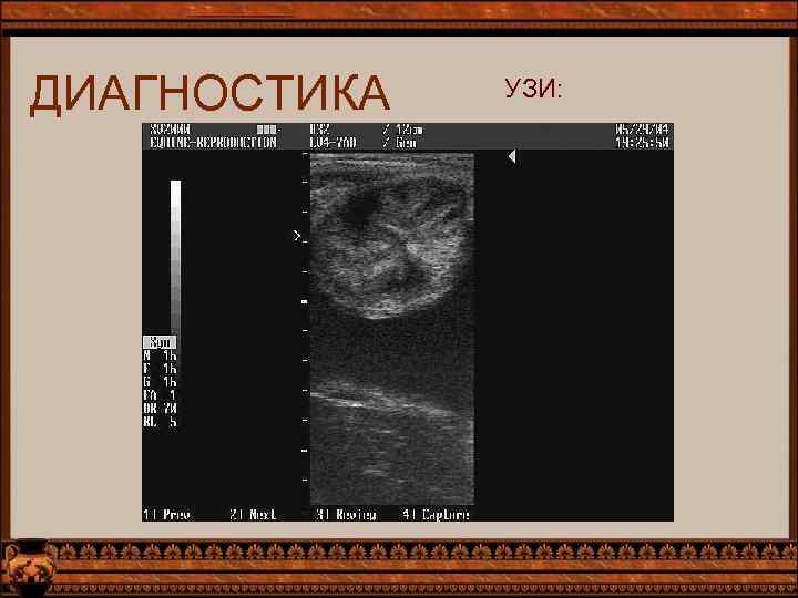 ДИАГНОСТИКА УЗИ: 