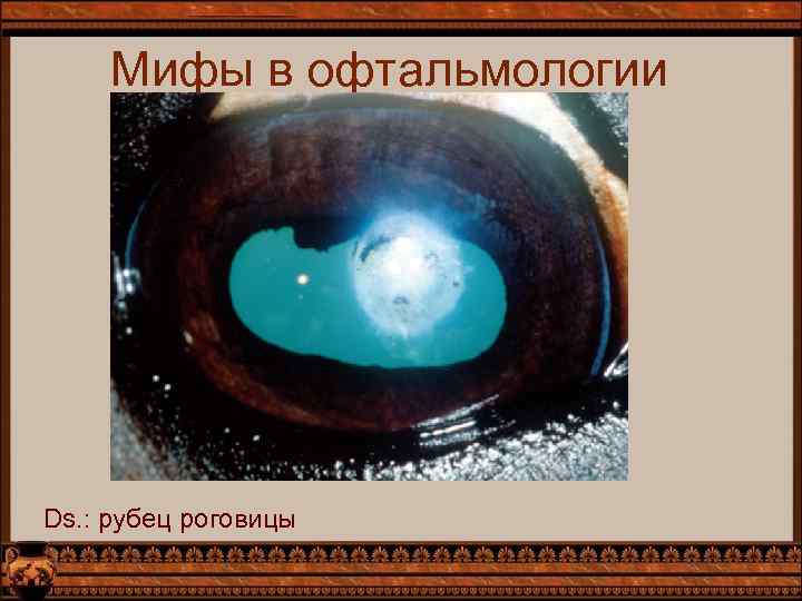 Мифы в офтальмологии Ds. : рубец роговицы 