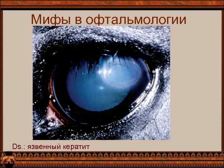 Мифы в офтальмологии Ds. : язвенный кератит 