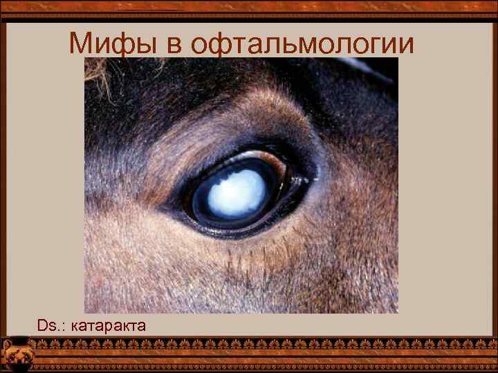 Мифы в офтальмологии Ds. : катаракта 