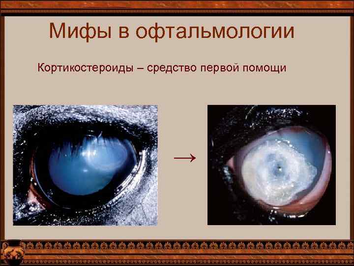 Мифы в офтальмологии Кортикостероиды – средство первой помощи → 