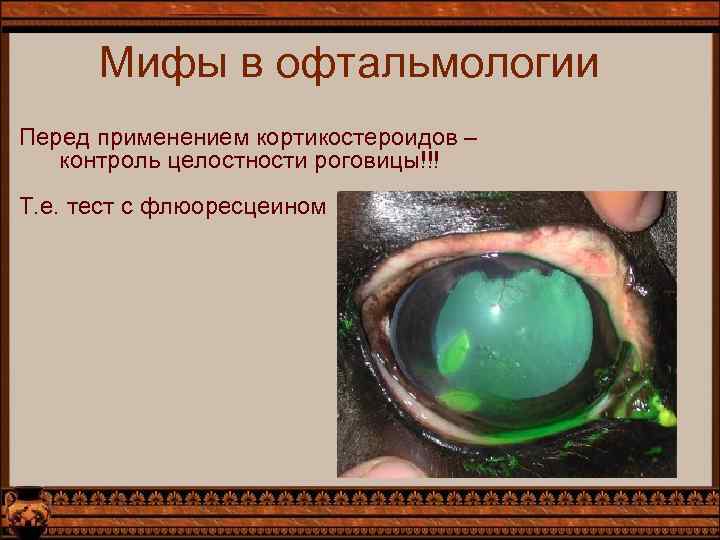 Мифы в офтальмологии Перед применением кортикостероидов – контроль целостности роговицы!!! Т. е. тест с