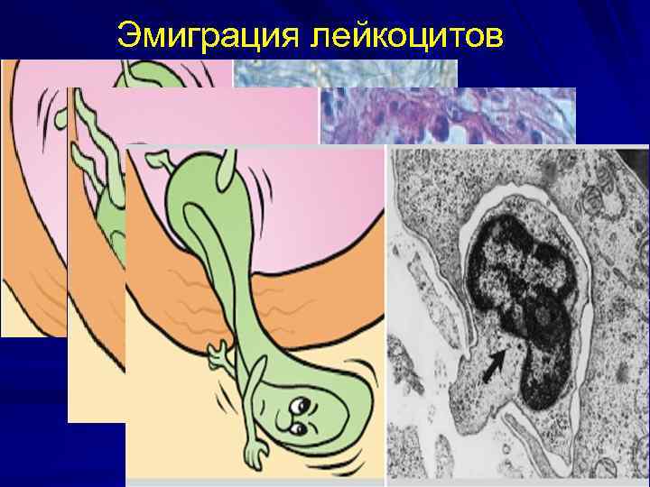 Эмиграция лейкоцитов 