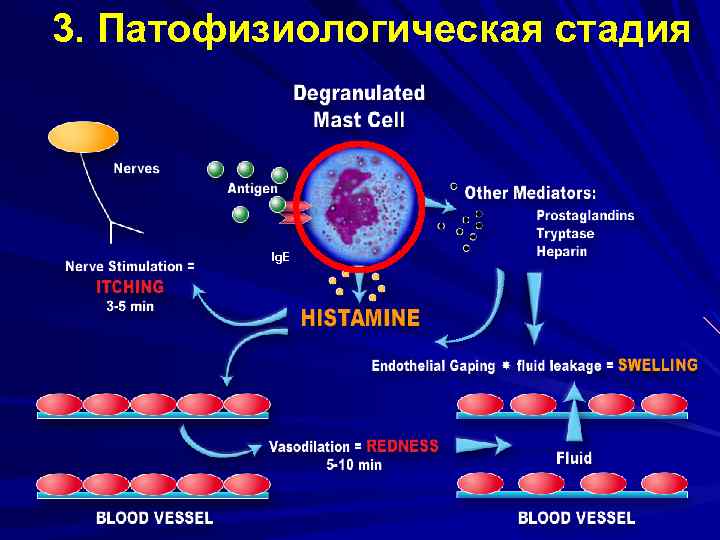 3. Патофизиологическая стадия Ig. E 