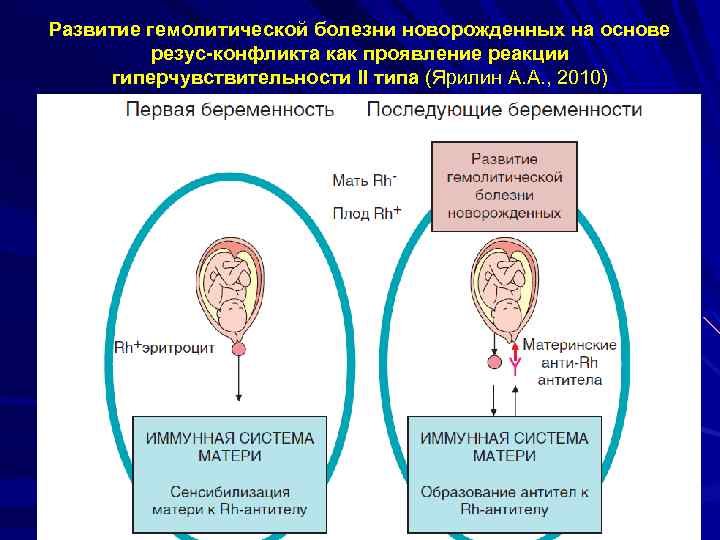 Развитие гемолитической болезни новорожденных на основе резус-конфликта как проявление реакции гиперчувствительности II типа (Ярилин