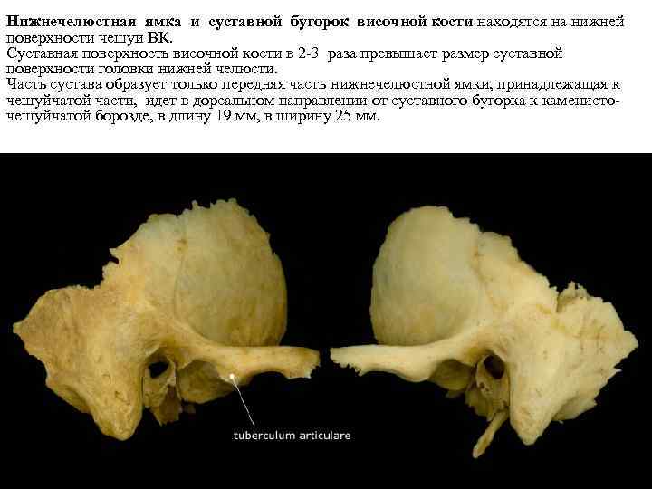 Нижнечелюстная ямка и суставной бугорок височной кости находятся на нижней поверхности чешуи ВК. Суставная
