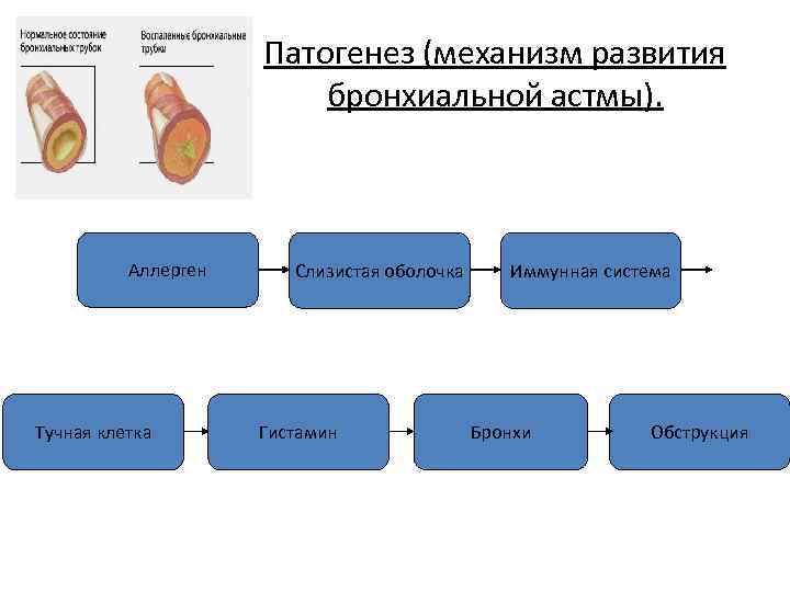 Патогенез (механизм развития бронхиальной астмы). Аллерген Тучная клетка Слизистая оболочка Гистамин Иммунная система Бронхи