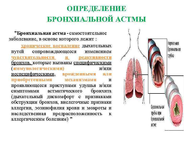 ОПРЕДЕЛЕНИЕ БРОНХИАЛЬНОЙ АСТМЫ "Бронхиальная астма - самостоятельное заболевание, в основе которого лежит : хроническое