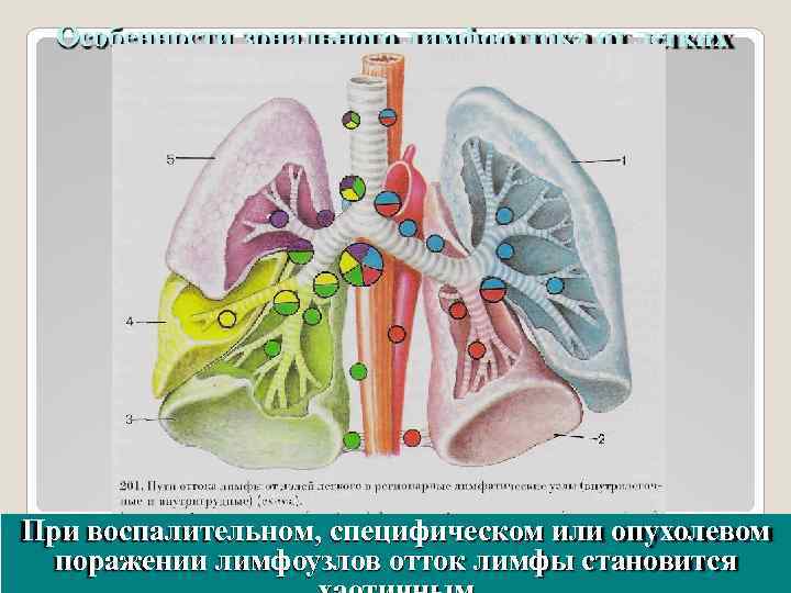 Особенности зонального лимфооттока от легких При воспалительном, специфическом или опухолевом поражении лимфоузлов отток лимфы