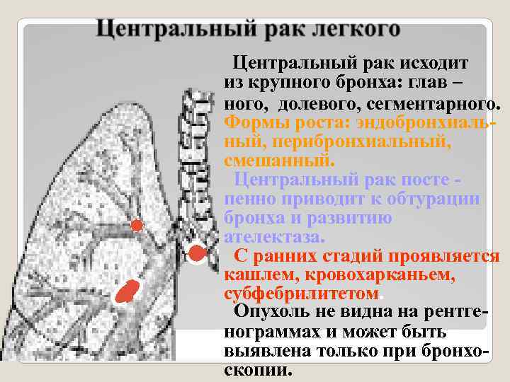 Центральный рак исходит из крупного бронха: глав – ного, долевого, сегментарного. Формы роста: эндобронхиальный,