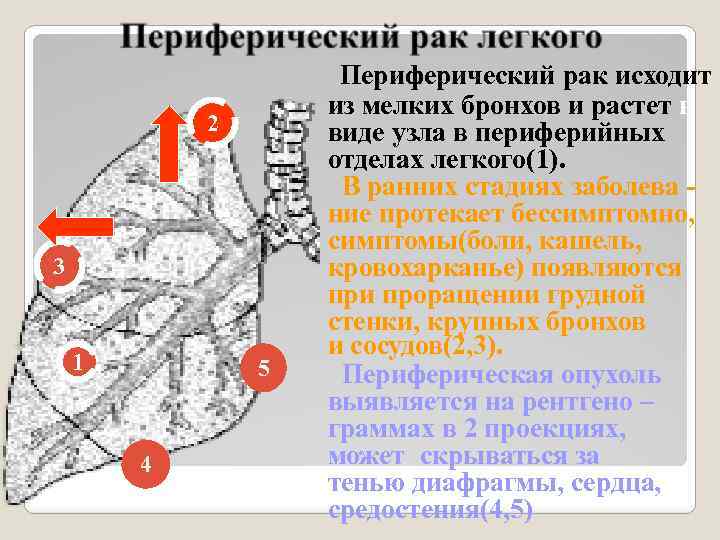 2 3 1 5 4 Периферический рак исходит из мелких бронхов и растет в