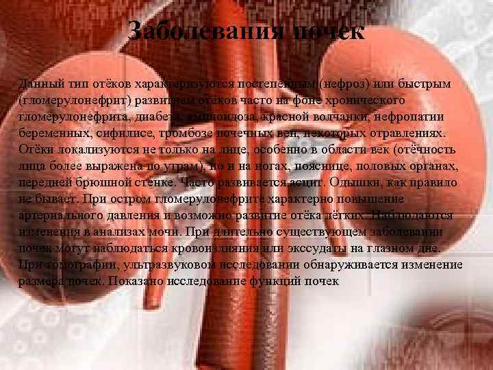 Заболевания почек Данный тип отёков характеризуются постепенным (нефроз) или быстрым (гломерулонефрит) развитием отёков часто