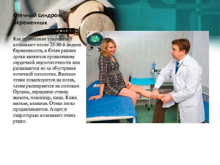 Отечный синдром беременных Как проявление токсикоза возникают после 25 -30 -й недели беременности, в