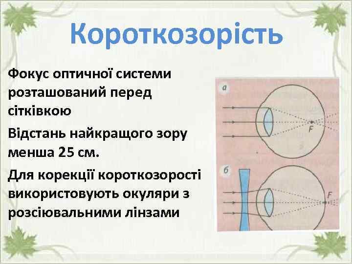 Короткозорість Фокус оптичної системи розташований перед сітківкою Відстань найкращого зору менша 25 см. Для