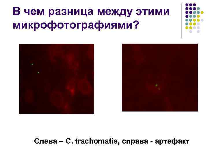 В чем разница между этими микрофотографиями? Слева – C. trachomatis, справа - артефакт 