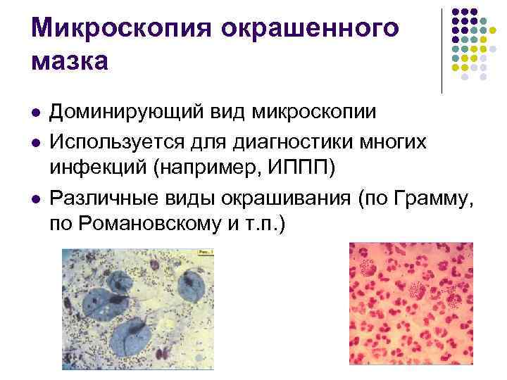 Микроскопия окрашенного мазка l l l Доминирующий вид микроскопии Используется для диагностики многих инфекций