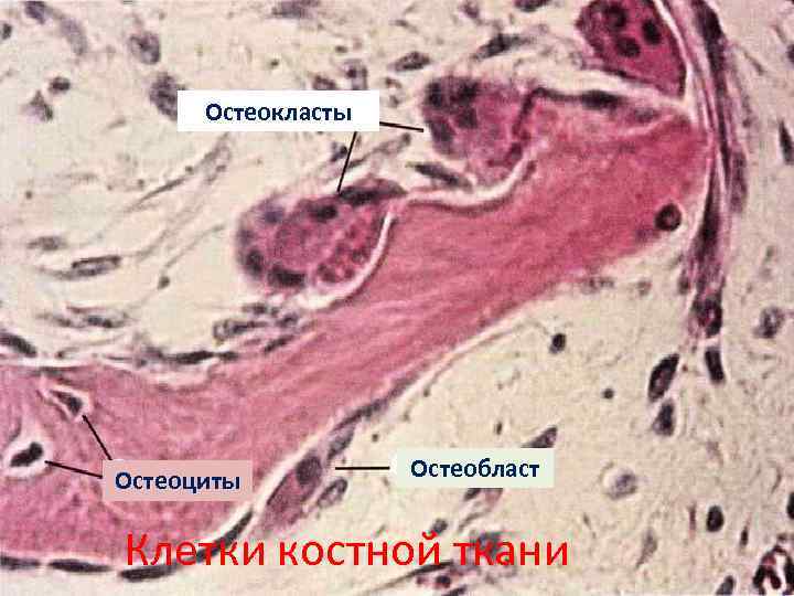 Остеокласты и остеобласты картинки