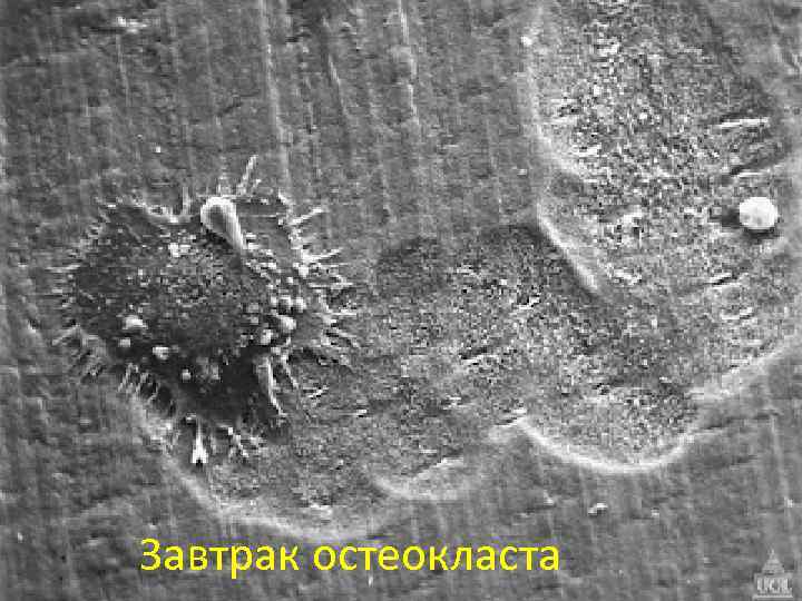 Завтрак остеокласта 