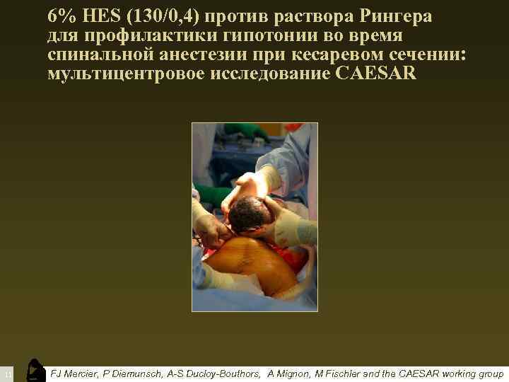 6% HES (130/0, 4) против раствора Рингера для профилактики гипотонии во время спинальной анестезии