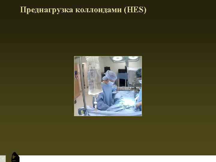 Преднагрузка коллоидами (HES) 7 