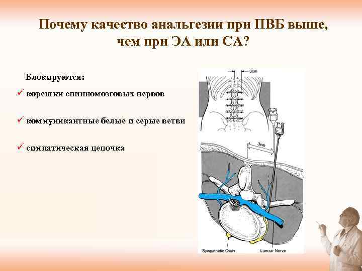 Почему качество анальгезии при ПВБ выше, чем при ЭА или СА? Блокируются: ü корешки