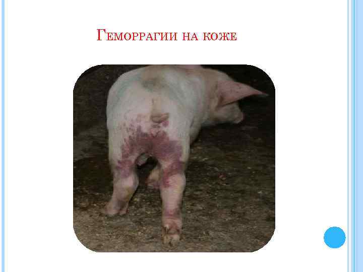 ГЕМОРРАГИИ НА КОЖЕ 