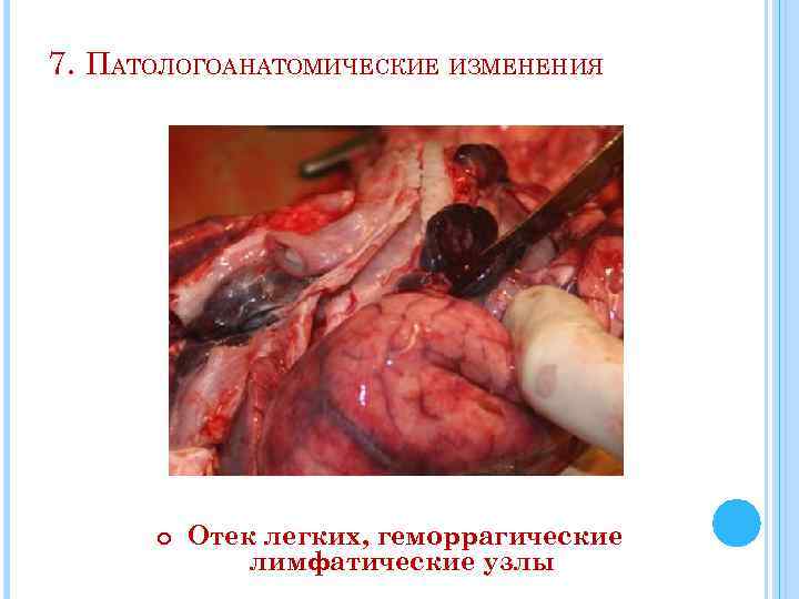 7. ПАТОЛОГОАНАТОМИЧЕСКИЕ ИЗМЕНЕНИЯ Отек легких, геморрагические лимфатические узлы 