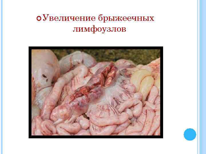  Увеличение брыжеечных лимфоузлов 