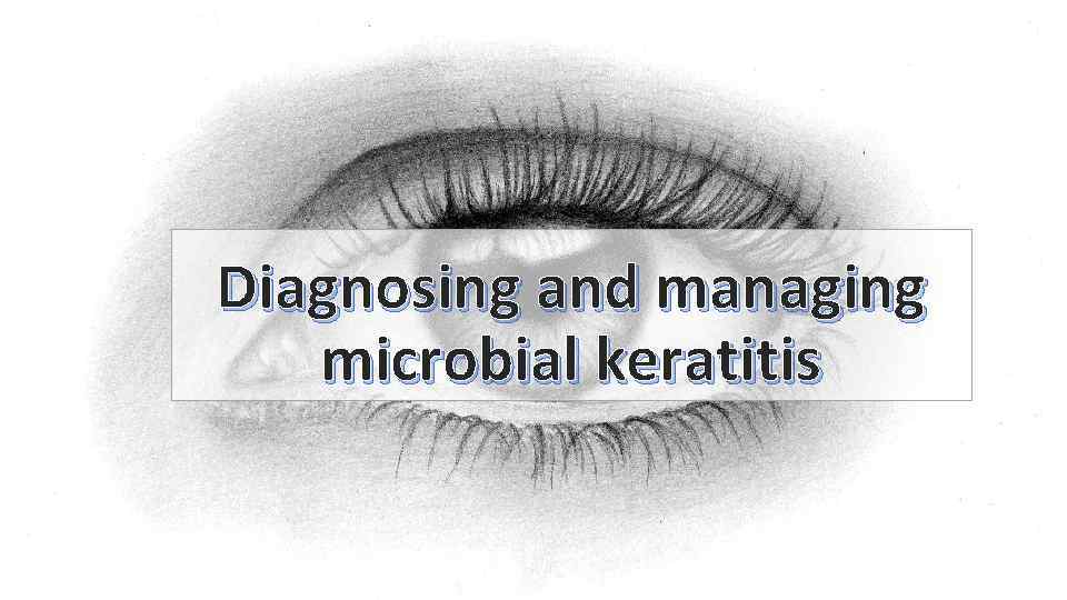 Diagnosing and managing microbial keratitis 