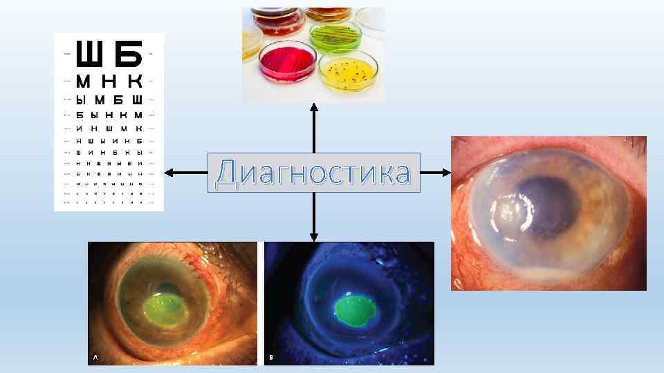 Диагностика 