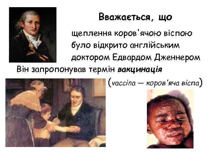 Вважається, що щеплення коров'ячою віспою було відкрито англійським доктором Едвардом Дженнером Він запропонував термін
