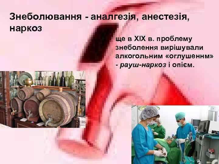 Знеболювання - аналгезія, анестезія, наркоз ще в XIX в. проблему знеболення вирішували алкогольним «оглушеннм»