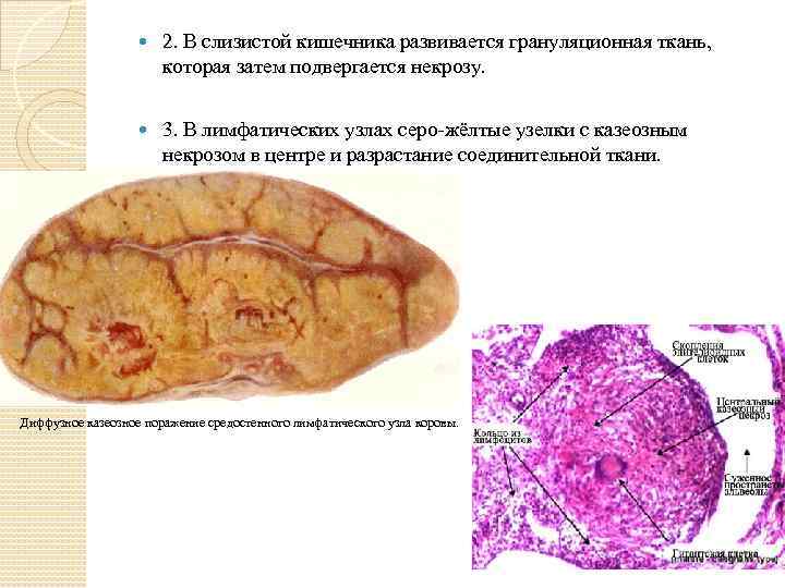  2. В слизистой кишечника развивается грануляционная ткань, которая затем подвергается некрозу. 3. В